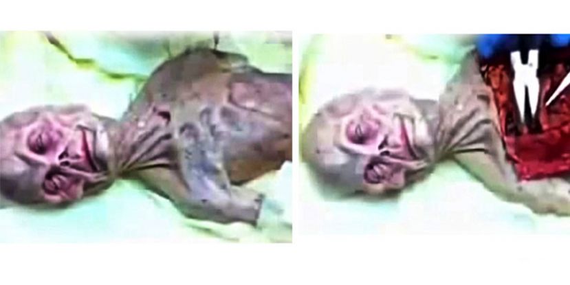 Alien Autopsy Video Leaked From Russian KGB